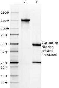 SDS-PAGE analysis of Anti-Histone H1 Antibody [AE-4] under non-reduced and reduced conditions; showing intact IgG and intact heavy and light chains, respectively SDS-PAGE analysis confirms the integrity and purity of the antibody