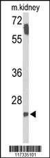 Anti-SMNDC1 Rabbit Polyclonal Antibody