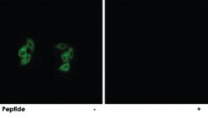 Anti-CSNK1A1 Rabbit Polyclonal Antibody