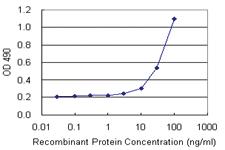 Anti-ALDH3A1 Polyclonal Antibody Pair