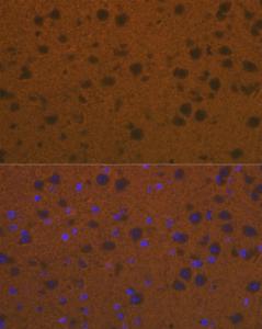 Immunofluorescence analysis of mouse brain cells using Anti-Talin 2 Antibody [ARC2335] (A309077) at a dilution of 1:100 (40X lens). DAPI was used to stain the cell nuclei (blue)