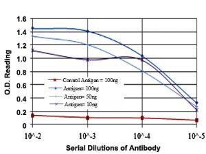 Anti-CK19 Mouse Monoclonal Antibody [clone: 4E8]