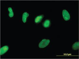 Anti-ZNF101 Mouse Monoclonal Antibody [clone: 2D5]