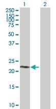 Anti-SIRPD Mouse Polyclonal Antibody