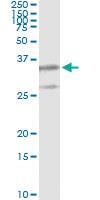 Anti-PSMB8 Antibody Pair