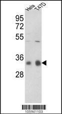 Anti-PPP1CC Rabbit Polyclonal Antibody (AP (Alkaline Phosphatase))