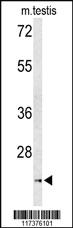 Anti-UNC119 Rabbit Polyclonal Antibody