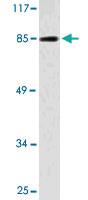 Anti-NBN Rabbit Polyclonal Antibody