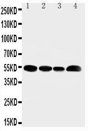 Anti-SLC16A4 Rabbit Polyclonal Antibody