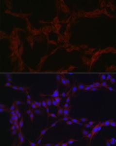 Anti-SLC39A14/ZIP-14 antibody