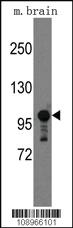 Anti-SEMA5A Rabbit Polyclonal Antibody