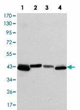 Anti-CK19 Mouse Monoclonal Antibody [clone: 4E8]