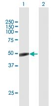 Anti-TSG101 Mouse Polyclonal Antibody