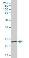 Anti-SIRPD Mouse Polyclonal Antibody