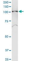 Anti-SNX19 Polyclonal Antibody Pair