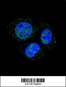 Anti-RB1 Rabbit Polyclonal Antibody (APC (Allophycocyanin))