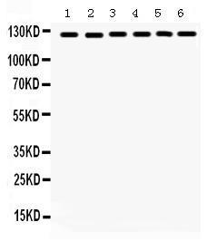 Anti-PTK2 Rabbit Polyclonal Antibody