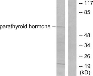 Western blot analysis of lysates from A549 cells using Anti-Parathyroid Hormone Antibody. The right hand lane represents a negative control, where the antibody is blocked by the immunising peptide.