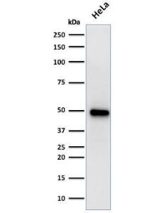 Western blot analysis of human HeLa cell lysate using Anti-FOXA1 Antibody [FOXA1/1519]