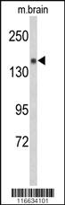 Anti-Semaphorin 5A Rabbit Polyclonal Antibody