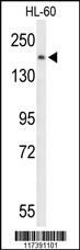 Anti-PLCB1 Rabbit Polyclonal Antibody