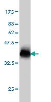 Anti-NPC1 Mouse Monoclonal Antibody [clone: 4H2]