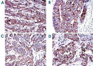 Anti-CK19 Mouse Monoclonal Antibody [clone: 4E8]