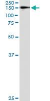 Anti-WWP1 Antibody Pair