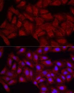 Immunofluorescence analysis of U2OS cells using Anti-Smg1 Antibody (A307835) at a dilution of 1:200 (40X lens). DAPI was used to stain the cell nuclei (blue)