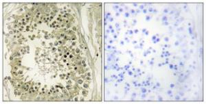 Immunohistochemical analysis of paraffin-embedded human testis tissue using Anti-HGS Antibody. The right hand panel represents a negative control, where the antibody was pre-incubated with the immunising peptide