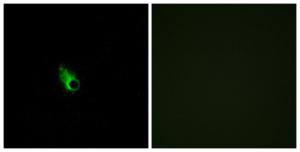 Antibody anti-OR52E1 A99515-100 100 µg