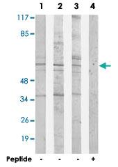 Anti-ACRBP Rabbit Polyclonal Antibody