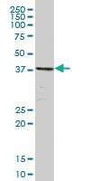 Anti-TSG101 Mouse Polyclonal Antibody