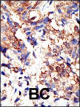 Anti-UBQLN2 Rabbit Polyclonal Antibody (APC (Allophycocyanin))