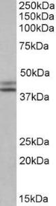 Anti-IDH1 Antibody (A84906) (0.1 µg/ml) staining of HepG2 lysate (35 µg protein in RIPA buffer). Primary incubation was 1 hour. Detected by chemiluminescence