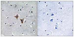 Anti-WASF4 antibody