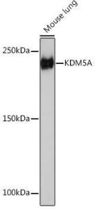 Western blot analysis of extracts of Mouse lung, using Anti-KDM5A/Jarid1A/RBBP2 Antibody [ARC1120] (A306168) at 1:1,000 dilution The secondary antibody was Goat Anti-Rabbit IgG H&L Antibody (HRP) at 1:10,000 dilution Lysates/proteins were present at 25 µg per lane