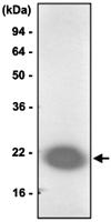 Anti-PARK7 Mouse Monoclonal Antibody [clone: 1B11]