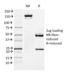 SDS-PAGE analysis of Anti-FOXA1 Antibody [FOXA1/1519] under non-reduced and reduced conditions; showing intact IgG and intact heavy and light chains, respectively. SDS-PAGE analysis confirms the integrity and purity of the antibody