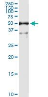 Anti-ALDH3A1 Polyclonal Antibody Pair