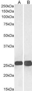 Anti-SNAP25 Antibody (A83291) (003 µg/ml) staining of Human Brain (Cerebellum) (A) and Mouse Brain (B lysates (35 µg protein in RIPA buffer) Primary incubation was 1 hour Detected by chemiluminescence