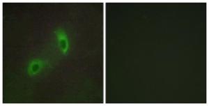 Immunofluorescence analysis of HUVEC cells using Anti-HGS Antibody. The right hand panel represents a negative control, where the antibody was pre-incubated with the immunising peptide