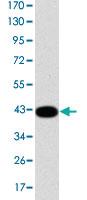 Anti-CK19 Mouse Monoclonal Antibody [clone: 4E8]