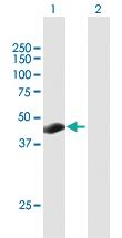 Anti-TSPY26P Mouse Polyclonal Antibody