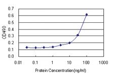 Anti-GRIN2C Polyclonal Antibody Pair