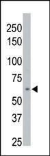 Anti-PPM1D Rabbit Polyclonal Antibody (APC (Allophycocyanin))