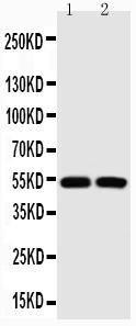 Anti-P53 Polyclonal Antibody