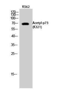 Antibody anti-P73 acetyl LYS321 100 µg