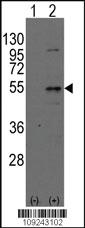 Anti-DTNBP1 Rabbit Polyclonal Antibody