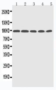 Anti-Progesterone Receptor Polyclonal Antibody